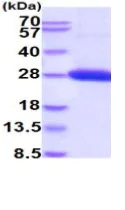 SDS-PAGE - Recombinant Human ULBP1 protein (His tag) (AB219423)