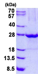 SDS-PAGE - Recombinant Human ULBP1 protein (His tag N-Terminus) (AB134517)