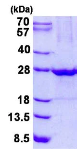 SDS-PAGE - Recombinant Human ULBP1 protein (His tag N-Terminus) (AB134517)