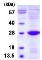 SDS-PAGE - Recombinant Human ULBP2 protein (denatured) (AB128443)
