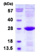 SDS-PAGE - Recombinant Human ULBP2 protein (denatured) (His tag N-Terminus) (AB128443)