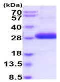 SDS-PAGE - Recombinant Human ULBP2 protein (His tag) (AB219455)