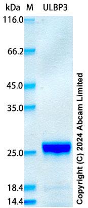 SDS-PAGE - Recombinant Human ULBP3 Protein Standard (His tag) (AB322753), expandable thumbnail