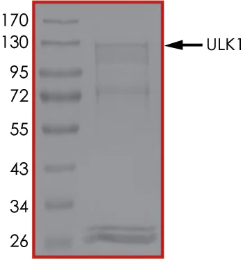 SDS-PAGE - Recombinant human ULK1 protein (AB125656)