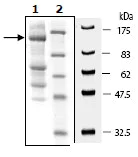 SDS-PAGE - Recombinant Human ULK1 protein (AB95322)