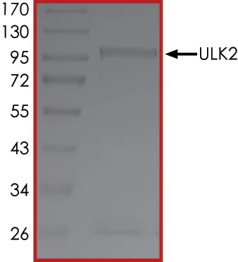 SDS-PAGE - Recombinant human ULK2 protein (GST tag N-Terminus) (AB125622)