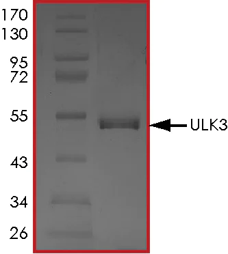 SDS-PAGE - Recombinant human ULK3 protein (AB101548)