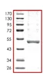 SDS-PAGE - Recombinant human ULK3 protein (His tag N-Terminus) (AB101548)