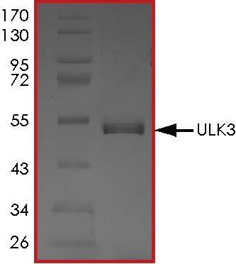 SDS-PAGE - Recombinant human ULK3 protein (His tag N-Terminus) (AB101548)