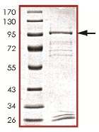 SDS-PAGE - Recombinant Human ULK4 protein (AB125657)
