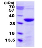 SDS-PAGE - Recombinant Human UNC119B protein (AB123153), expandable thumbnail