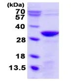SDS-PAGE - Recombinant Human UNC119B protein (His tag N-Terminus) (AB123153)