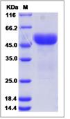 SDS-PAGE - Recombinant Human Unc5a protein (His tag) (AB276540)