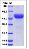 SDS-PAGE - Recombinant Human Unc5a protein (His tag) (AB276540)