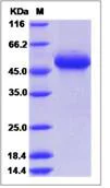 SDS-PAGE - Recombinant Human UNC5B protein (His tag) (AB276563)
