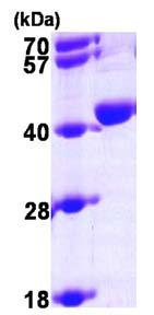 SDS-PAGE - Recombinant Human UPD protein (His tag N-Terminus) (AB96770)