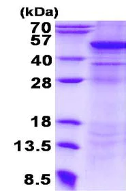 SDS-PAGE - Recombinant Human UQCRC2 protein (denatured) (AB134532)