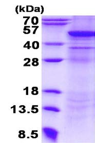 SDS-PAGE - Recombinant Human UQCRC2 protein (denatured) (His tag N-Terminus) (AB134532)
