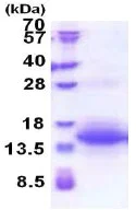 SDS-PAGE - Recombinant Human UQCRH protein (AB174416)