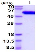 SDS-PAGE - Recombinant Human Urokinase protein (AB222437)