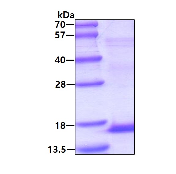 SDS-PAGE - Recombinant Human Uroplakin II/UPII protein (denatured) (His tag N-Terminus) (AB139621)