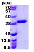 SDS-PAGE - Recombinant Human UROS protein (His tag N-Terminus) (AB107136)