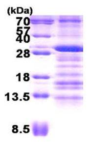 SDS-PAGE - Recombinant Human Use1 protein (AB156344)