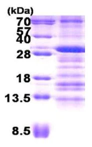 SDS-PAGE - Recombinant Human Use1 protein (His tag N-Terminus) (AB156344)