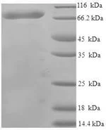 SDS-PAGE - Recombinant Human USH1C/Harmonin protein (Tagged) (AB239541)