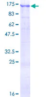 SDS-PAGE - Recombinant Human USP1 protein (GST tag N-Terminus) (AB132351)