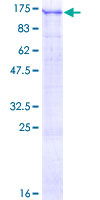 SDS-PAGE - Recombinant Human USP1 protein (Tagged) (AB132351)