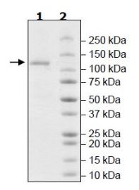 Recombinant human USP20 protein (Tagged)