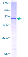 Recombinant Human USP24 protein