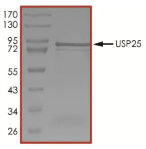 SDS-PAGE - Recombinant Human USP25 protein (Tagged) (AB269120)
