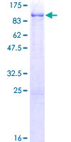 SDS-PAGE - Recombinant Human USP28 protein (AB163618)
