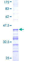 SDS-PAGE - Recombinant Human USP31 protein (AB163562)