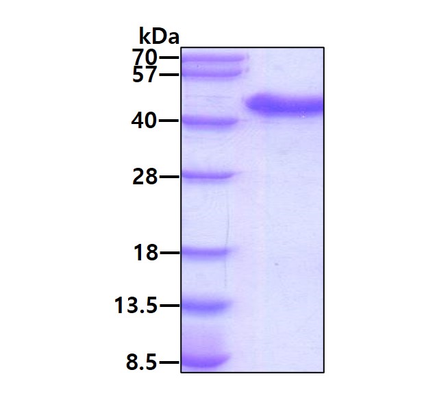SDS-PAGE - Recombinant Human USP46 protein (AB177681), expandable thumbnail