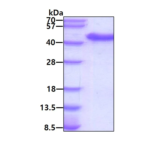 SDS-PAGE - Recombinant Human USP46 protein (His tag N-Terminus) (AB177681)