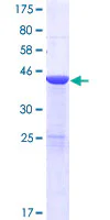 SDS-PAGE - Recombinant Human USP47 protein (GST tag N-Terminus) (AB162936)