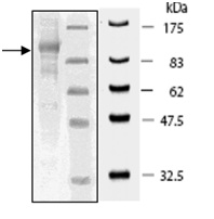SDS-PAGE - Recombinant human USP5 protein (AB198421), expandable thumbnail