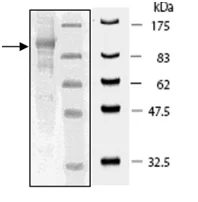 SDS-PAGE - Recombinant human USP5 protein (DDDDK tag N-Terminus) (AB198421)