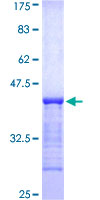 SDS-PAGE - Recombinant Human USP6 protein (GST tag N-Terminus) (AB160339)