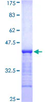 SDS-PAGE - Recombinant Human USP6 protein (GST tag N-Terminus) (AB160339)