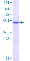 SDS-PAGE - Recombinant Human USP9x protein (AB152844), expandable thumbnail