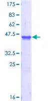 SDS-PAGE - Recombinant Human USP9x protein (AB152844)
