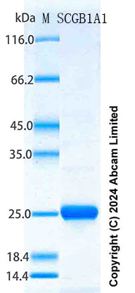 SDS-PAGE - Recombinant Human Uteroglobin Protein Standard (His tag) (AB316647)
