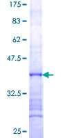 SDS-PAGE - Recombinant Human UTP14A protein (GST tag N-Terminus) (AB161168)
