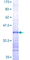 SDS-PAGE - Recombinant Human UTP14A protein (GST tag N-Terminus) (AB161168)
