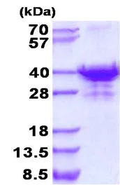 SDS-PAGE - Recombinant Human UTP23 protein (His tag N-Terminus) (AB134613)