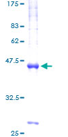 SDS-PAGE - Recombinant Human VAMP4 protein (Tagged) (AB275912), expandable thumbnail
